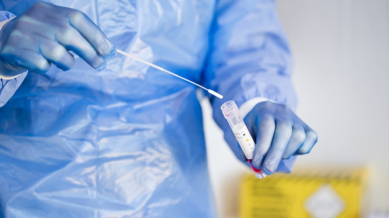 В ВОЗ рекомендовали&nbsp;десятидневную изоляцию для людей с симптомами COVID-19