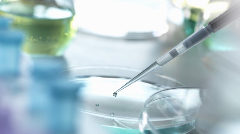 В Роспотребнадзоре исключили угрозу эпидемии сибирской язвы в России