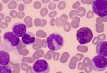 «Избирательное уничтожение»: российские учёные нашли способ разрушать раковые клетки изнутри