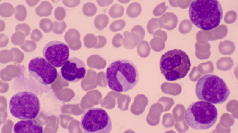 «Избирательное уничтожение»: российские учёные нашли способ разрушать раковые клетки изнутри