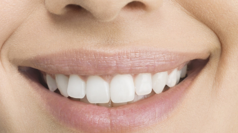 В ГД назвали категории россиян, которым положено бесплатное протезирование зубов