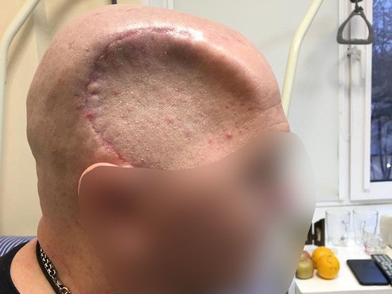 «Ангел-хранитель толкнул меня»: боец с позывным Капсула рассказал, как трижды чудом выжил на фронте