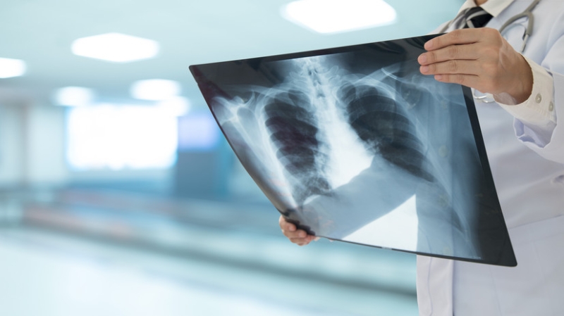 Прокуратура: в Приморье у школьников выявили туберкулёз