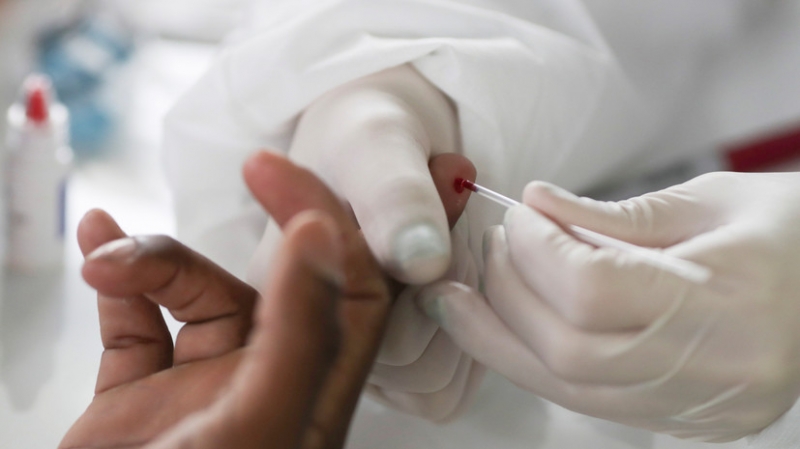 Число случаев коронавируса в Бразилии достигло 6 314 740