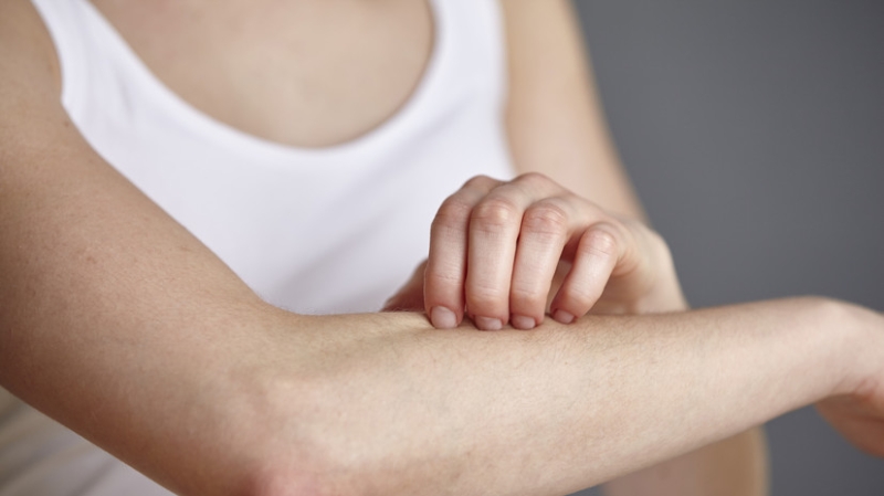 Дерматолог Филёва рассказала, в чём главная опасность витилиго