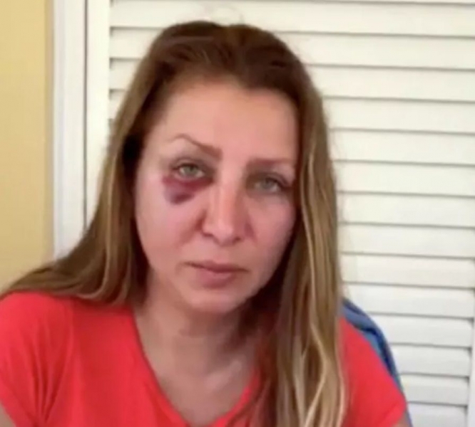 &laquo;Мы оказались на земле, дальше нас пинали ногами&raquo;: россиянки рассказали о нападениях украинцев в Европе