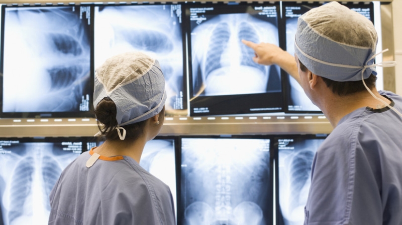 Онколог Астраханцев дал рекомендации для снижения риска возникновения рака лёгкого