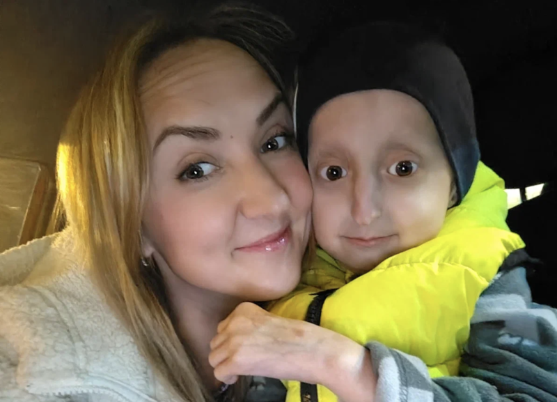 «У нас может и не быть завтра»: как в России живут дети с прогерией