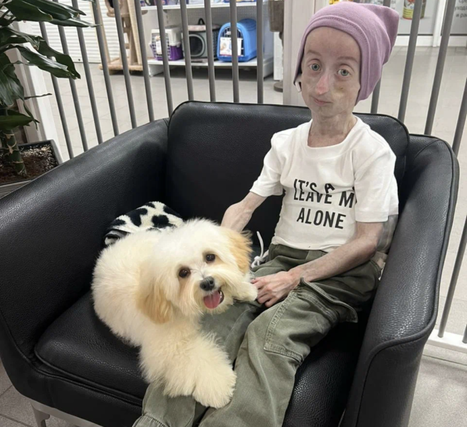 «У нас может и не быть завтра»: как в России живут дети с прогерией