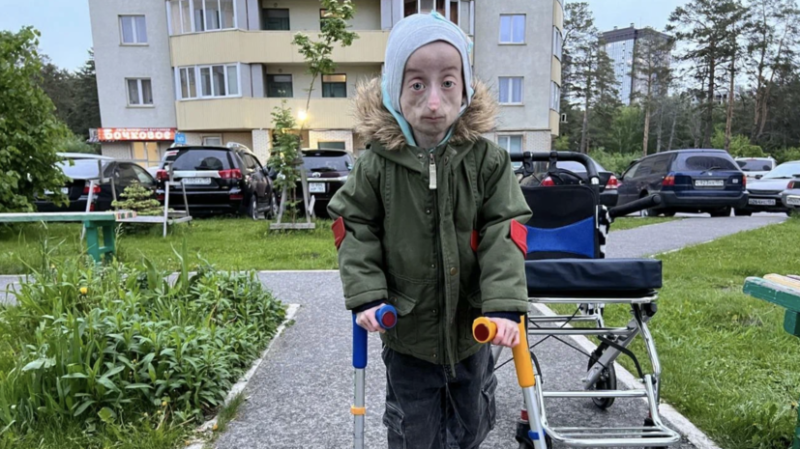 «У нас может и не быть завтра»: как в России живут дети с прогерией