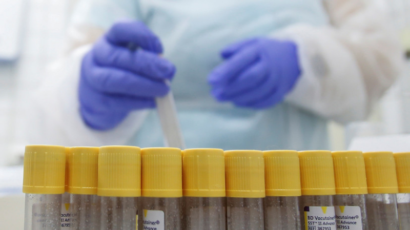 В Греции за сутки выявили 4309 новых случаев коронавируса