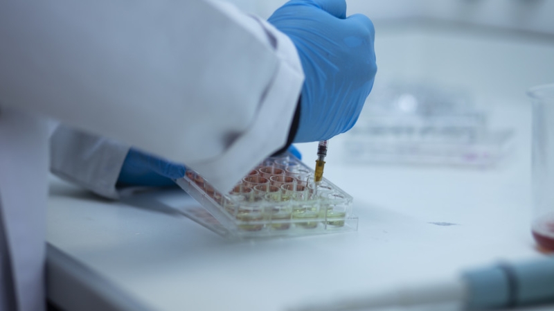 В Роспотребнадзоре исключили угрозу распространения сибирской язвы в России